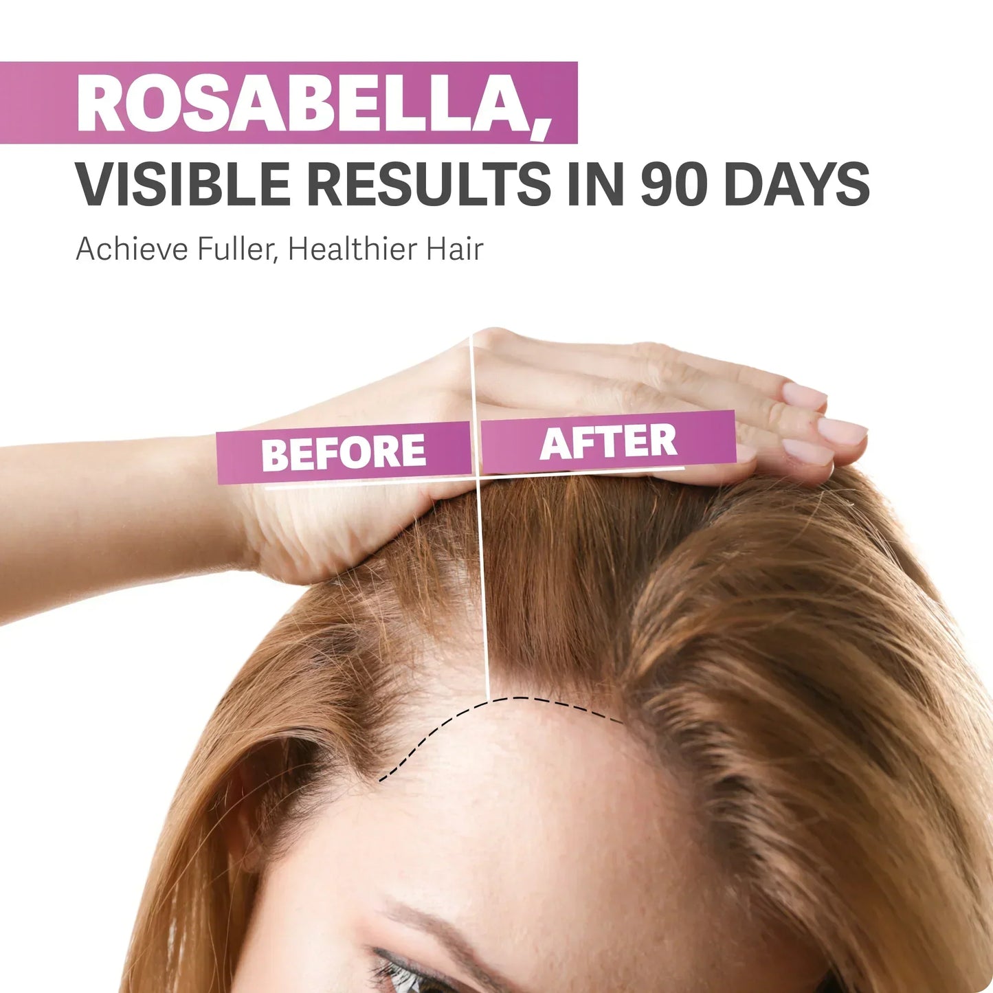 Rosabella™ Viral Hair Growth Gummies (Limited Time Offer)
